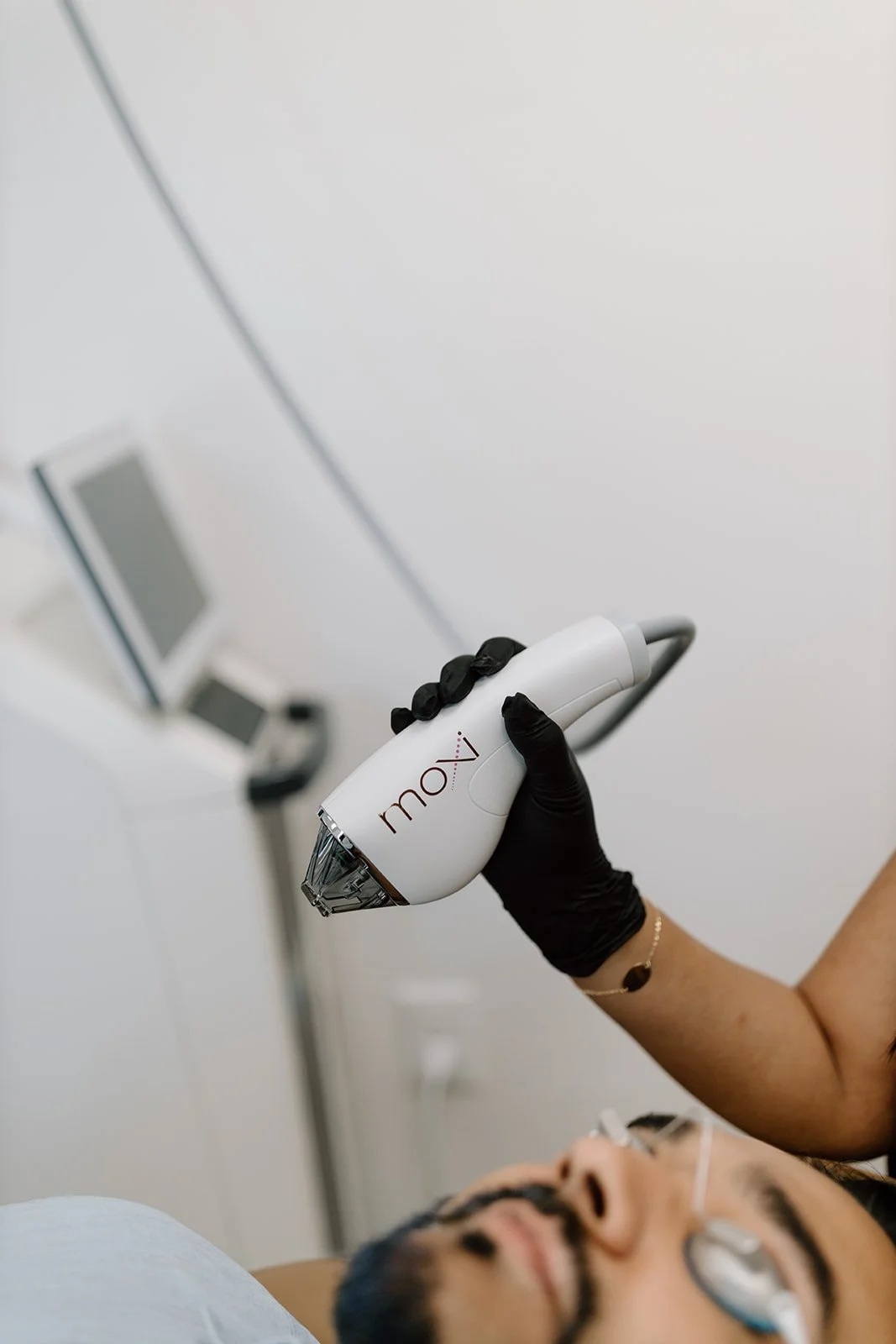 Moxie Laser Skin Treatment in OKC