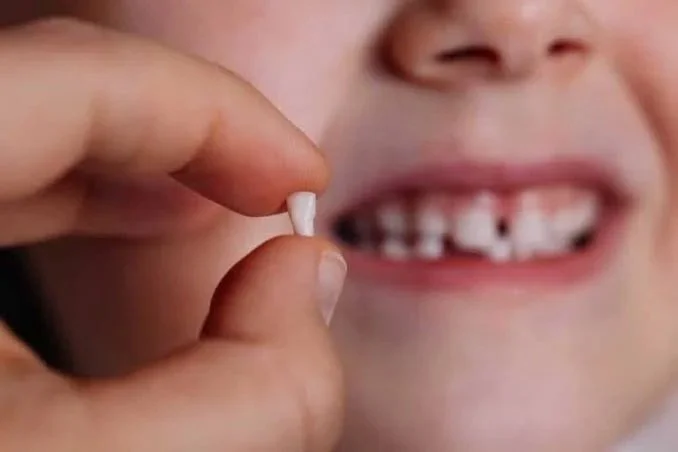 Why Baby Teeth Matter More Than You Think