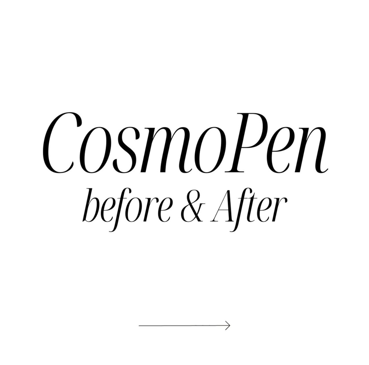 Glow, refine, restore ✨
These before &amp; afters say it all&mdash;powered by advanced microneedling with the CosmoFrance pen + HealMD CBD for next-level skin recovery and results.
Microneedling works by creating controlled micro-channels in the skin