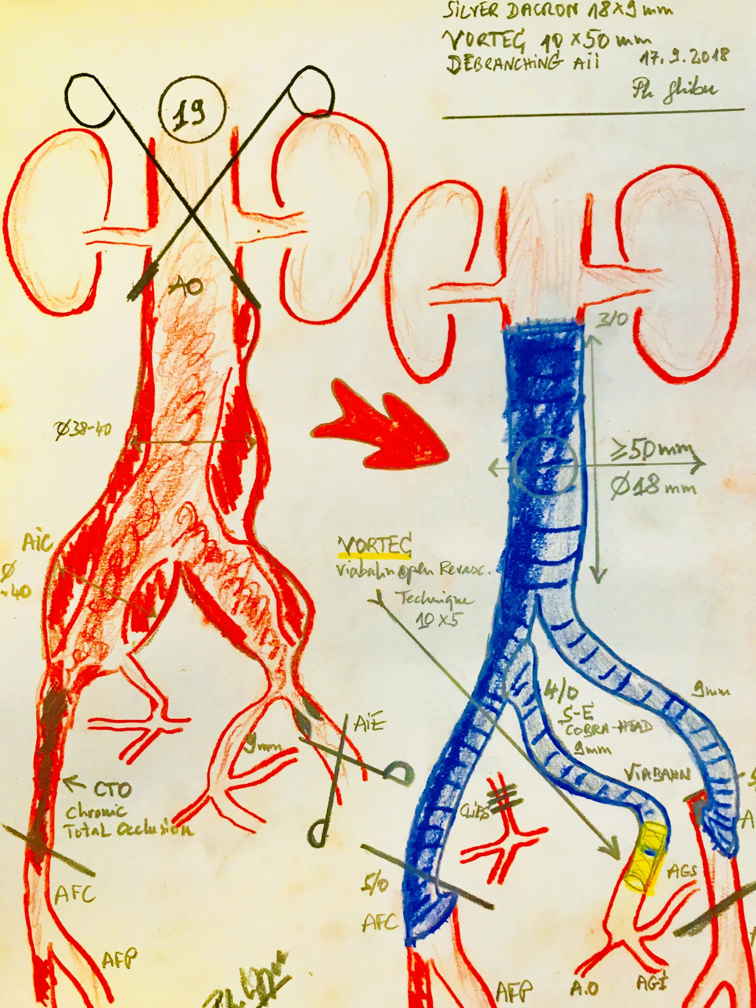 Philipp Ghibu Illustration 4.JPEG