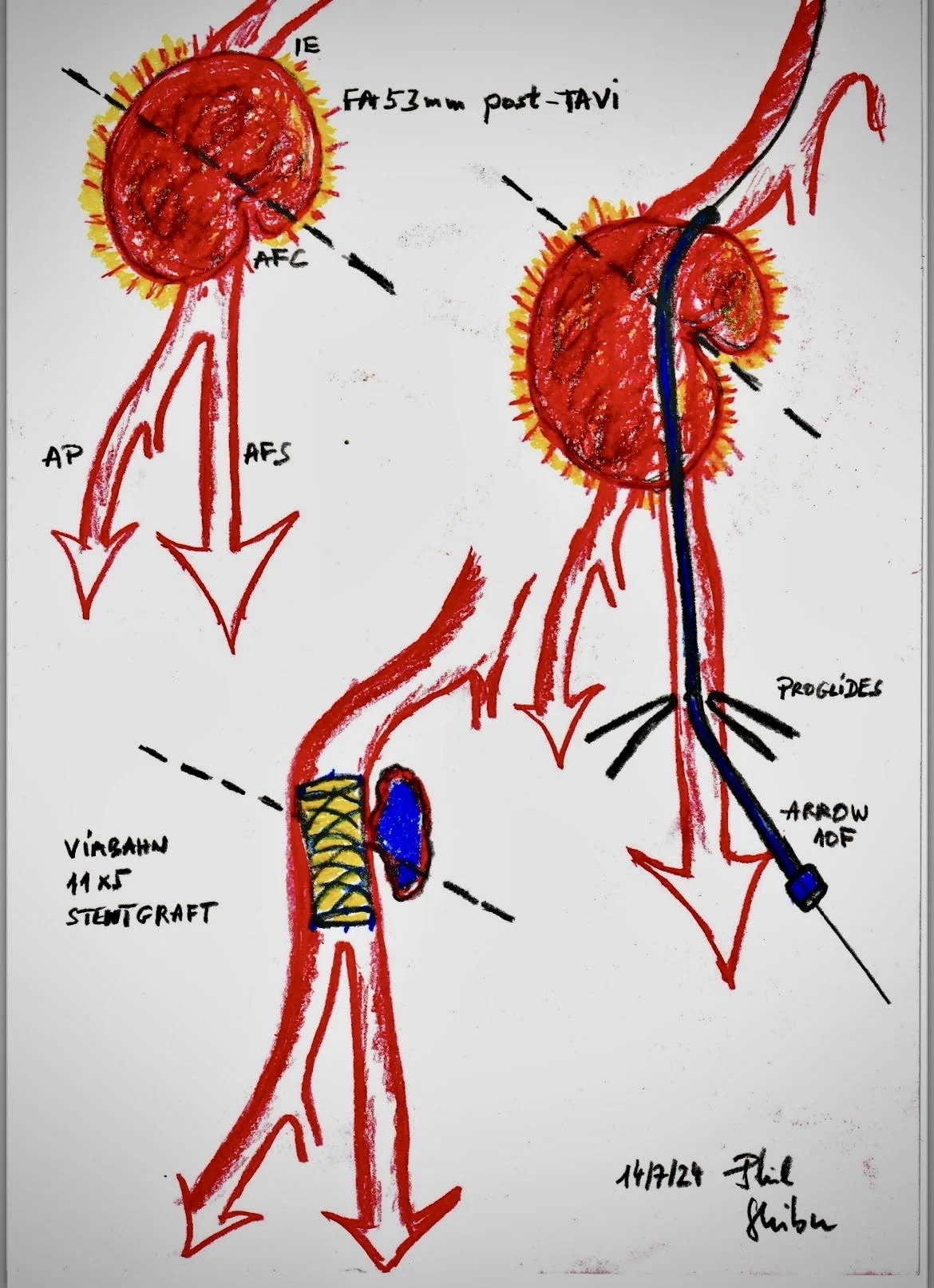 „Ein Bild sagt mehr als tausend Worte – besonders in der Gefässchirurgie.“
