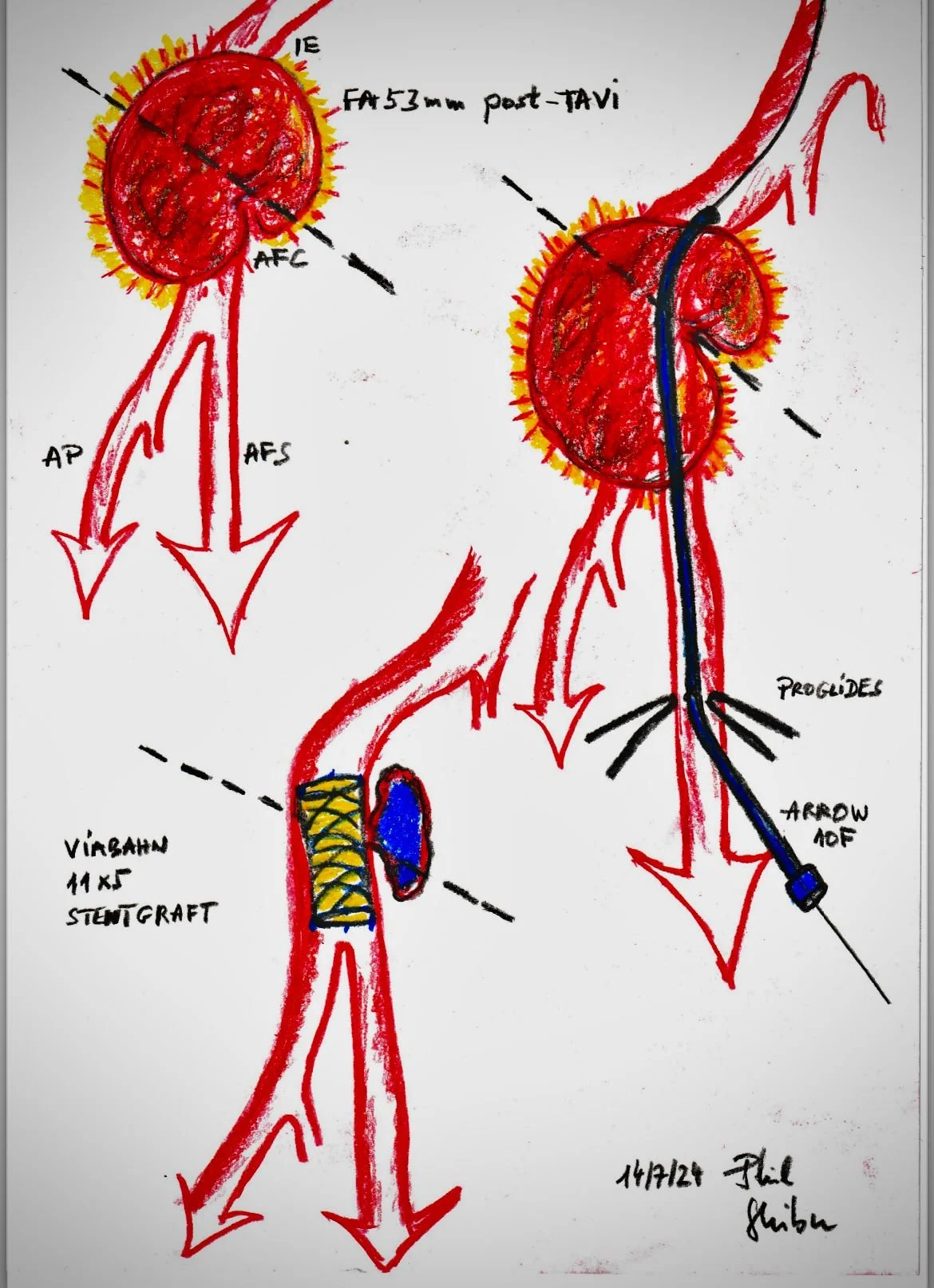 Philipp Ghibu Illustration 2.JPEG