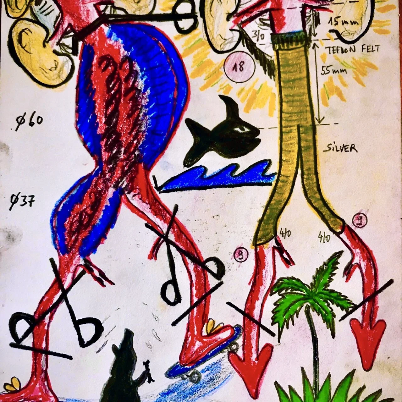 Open Aorto-iliac Repair for aortic aneurysm - Teflon Felt Reinforced Dr. Ghibu