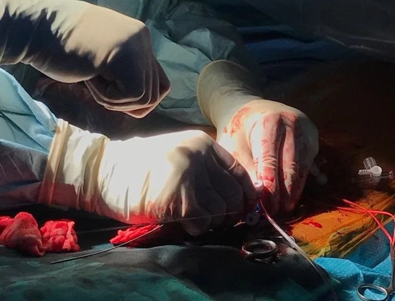 Karotischirurgie Zürich	Schlaganfall-Prävention