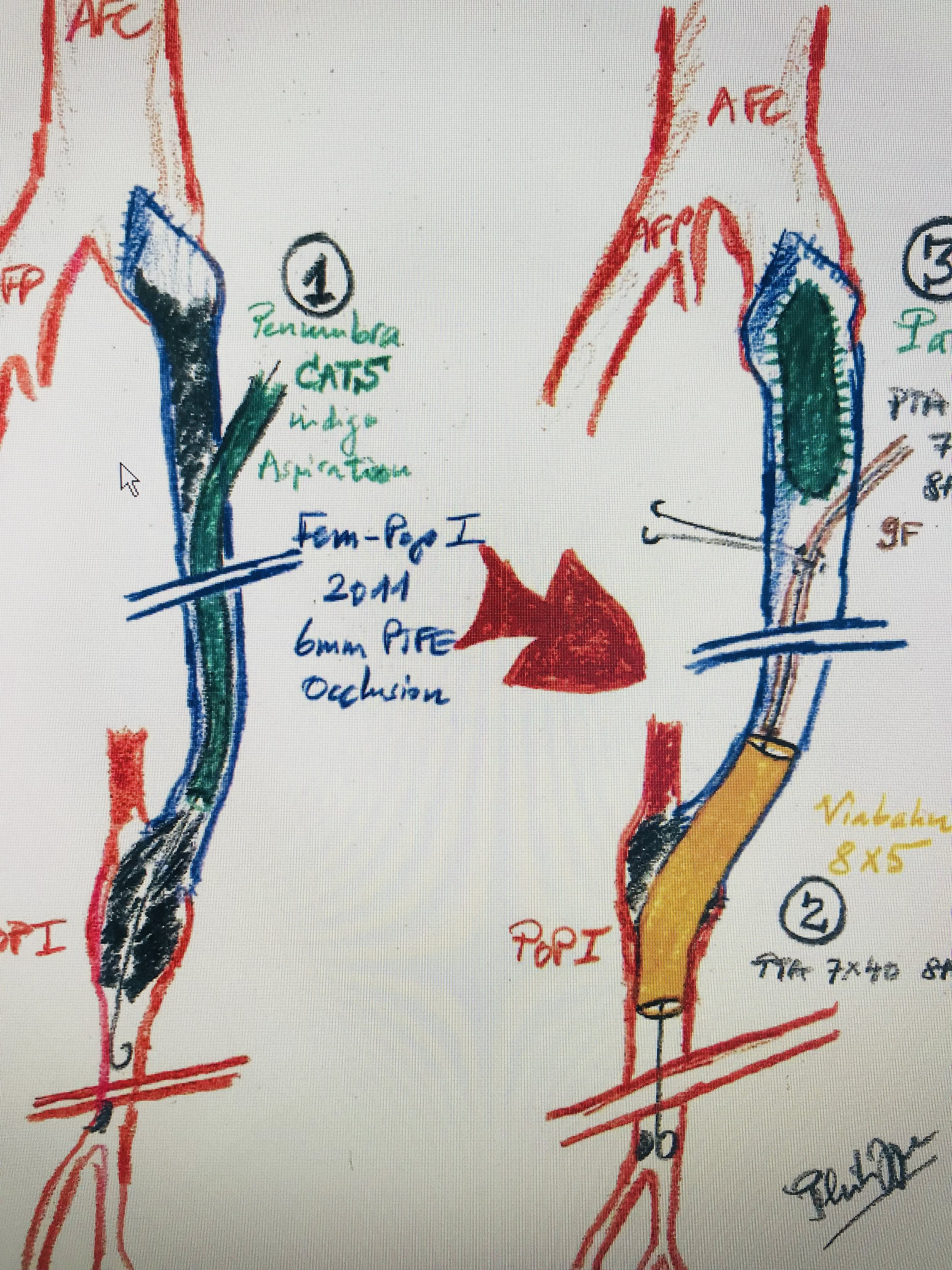 Philipp Ghibu Illustration.JPEG