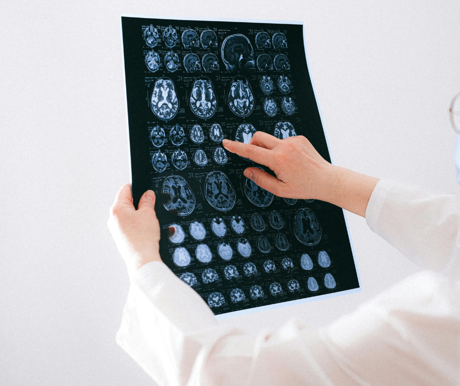 Rural Patients face Neurological Risks