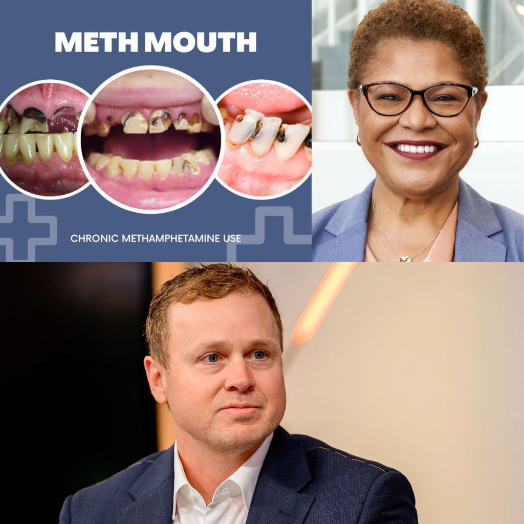 Free Teeth for Meth Addicts, Paid For By Us? Angelenos, Why Are You Putting Up With This?