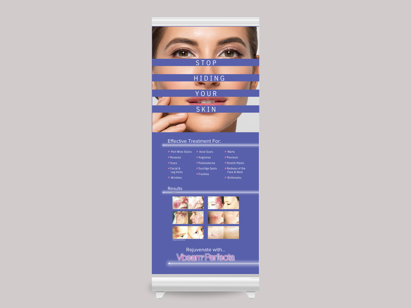 Patient Pop Up Banner
