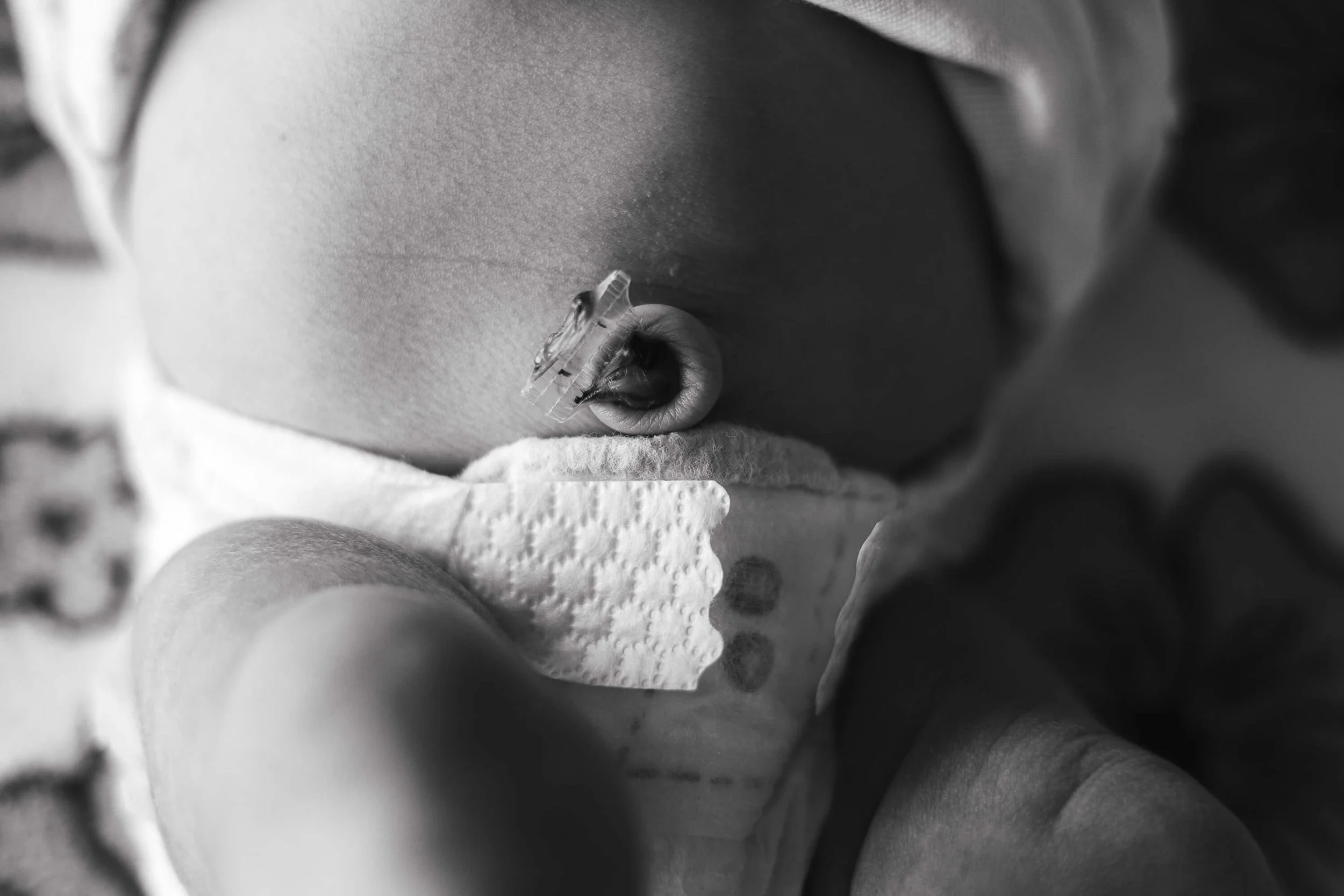 A black and white image of a dried umbilical cord and belly button of a newborn girl