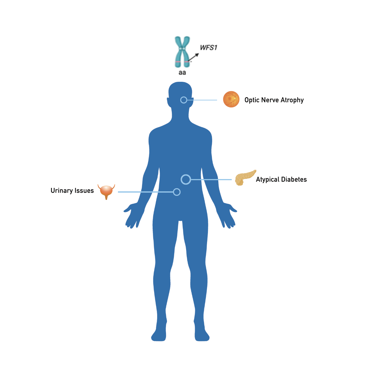 What are the symptoms of Ashkenazi Jewish Wolfram syndrome and how are they managed? 