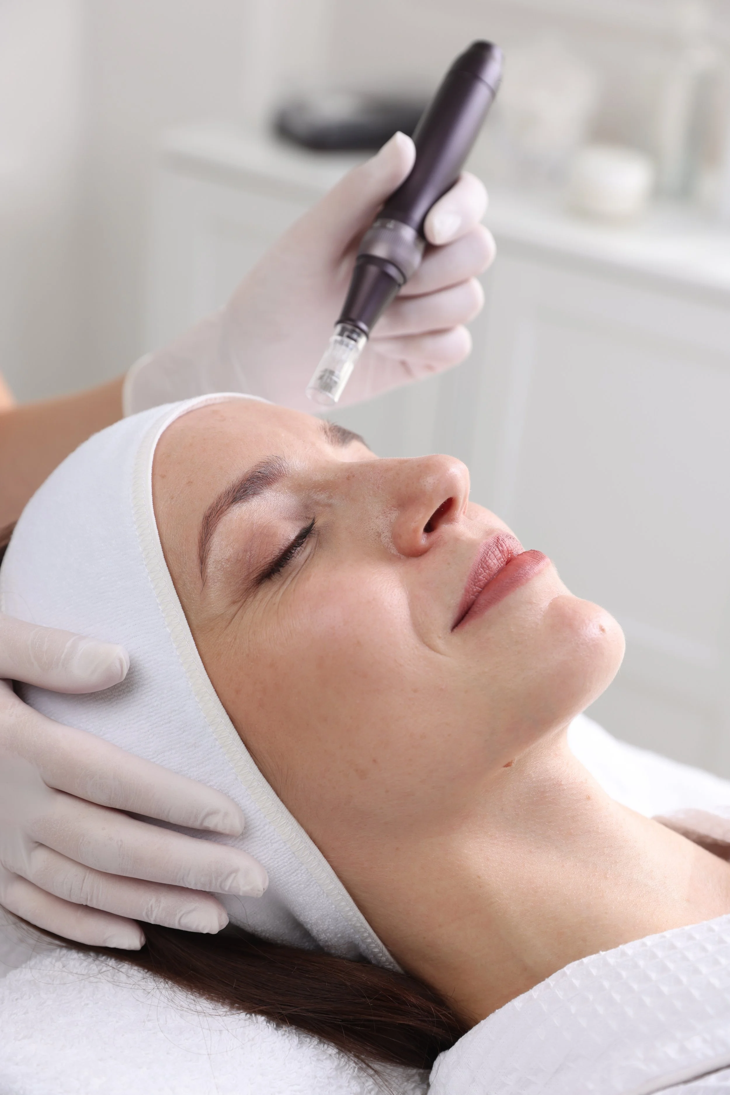 Skin Needling in Melbourne: What Does It Actually Do for Your Skin?