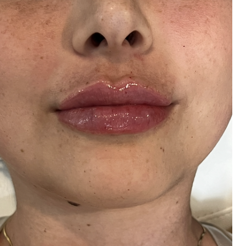 The Refined Ritual | Aesthetic Services | La Jolla California Med Spa