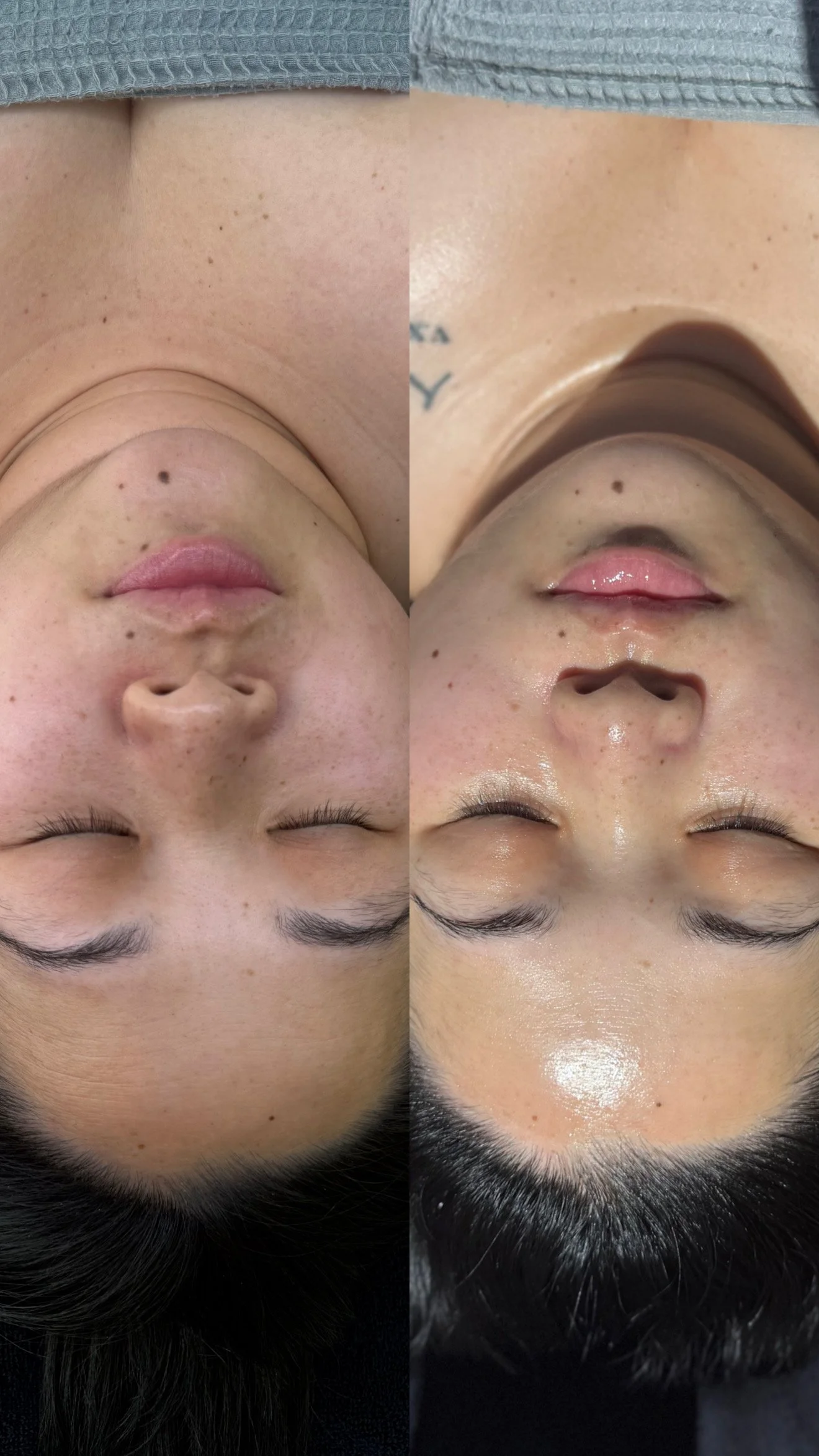 Your Skin Isn't Dull Because You Don't Drink Enough Water