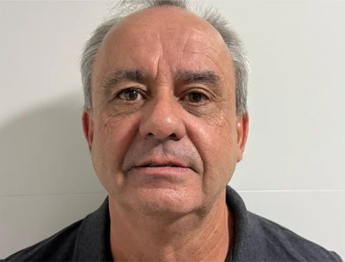 Edelson José M. Miranda