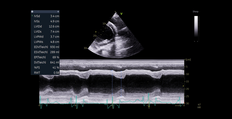 cardiac5.png