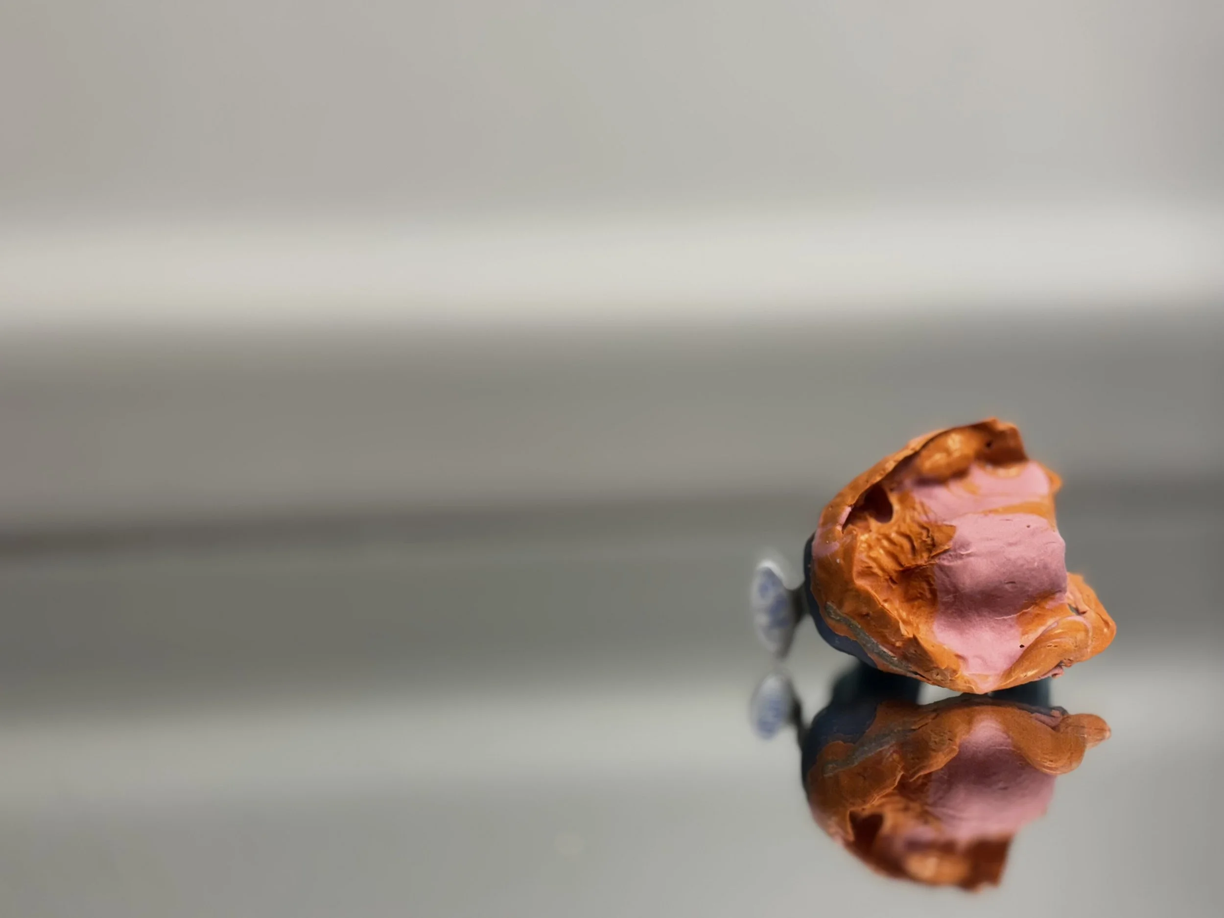 Where It All Starts: Dental Impressions &amp; Scans That Lead to Better Denture Outcomes