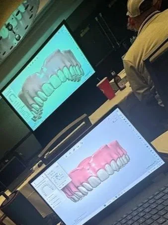 Digital denture CAD design software shown during dental laboratory training presentation