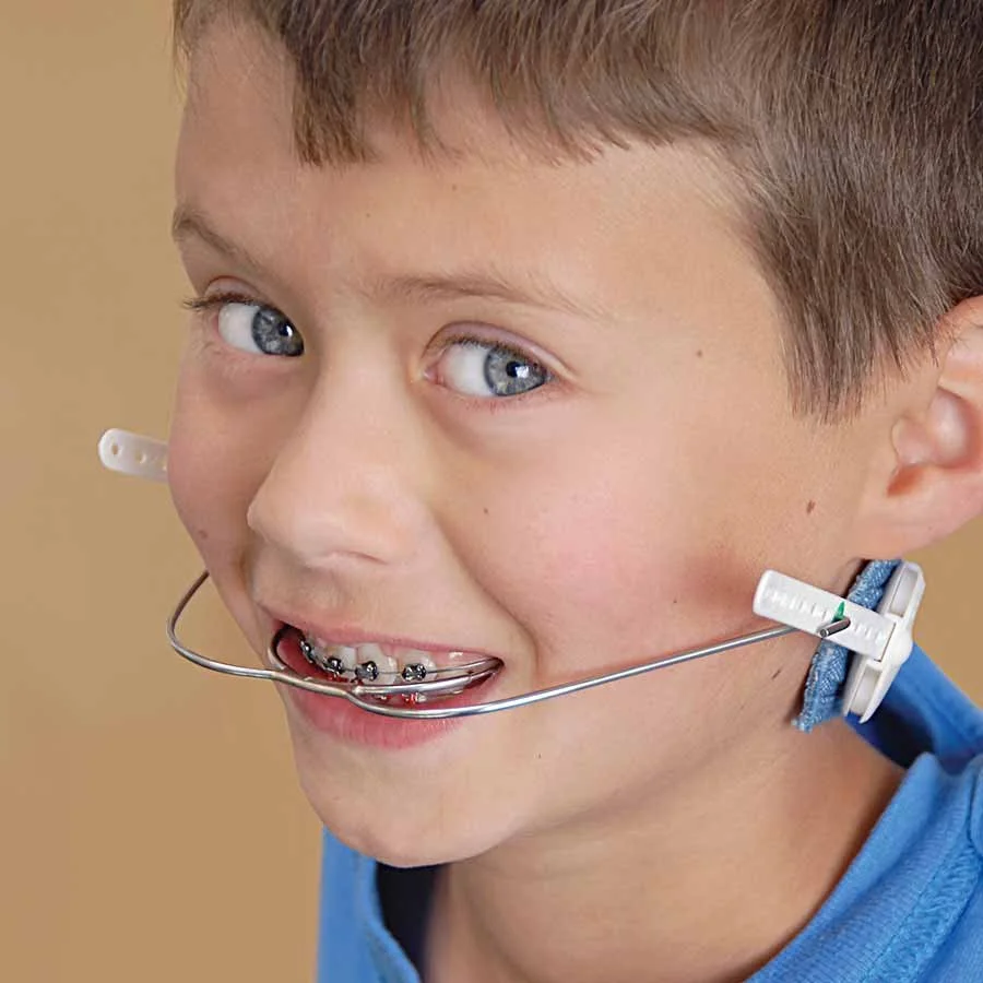 Headgear (Including Reverse) -- Worn outside the mouth to guide jaw growth and tooth position. Usually worn at night. Follow wear-time instructions closely and store it safely when not in use.
