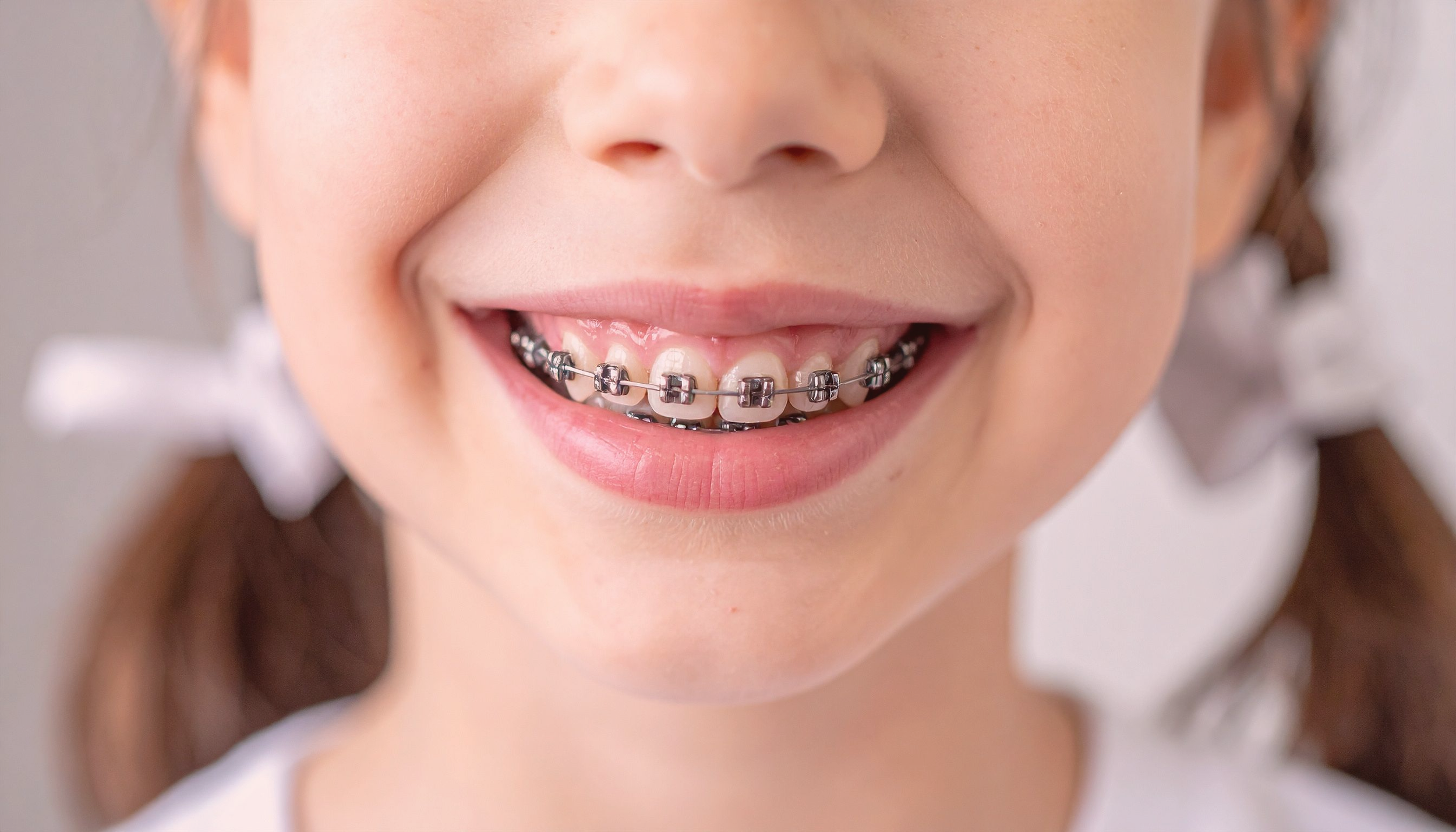 When should my child see an orthodontist? Image of child with braces.