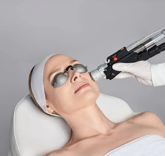 Motus AZ+ Laser Treatment