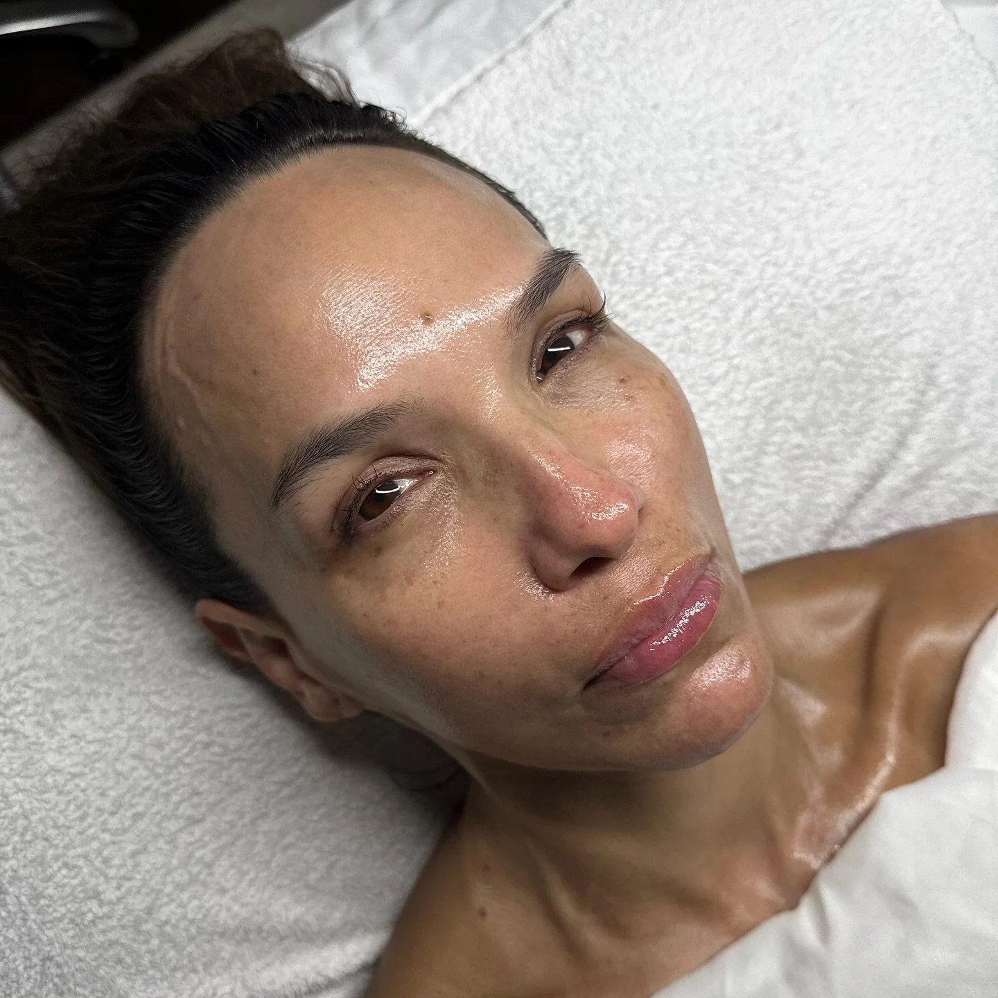 glowy &amp; dewy 🫧

#skin #facials #bullheadcityesthetician #bullheadcityfacials #skintreatments #beforeandafter #beforeandafterskin #radiantaf