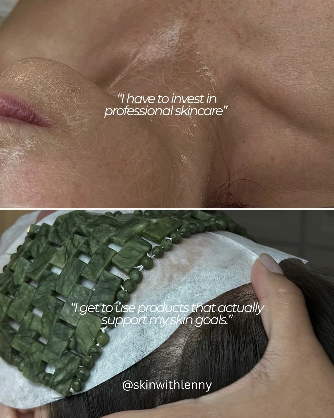 Your skin journey become so much lighter when you stop looking at it as something you have to do and start looking at it as something you GET to do 🤎

Mindset plays such a huge role in the healing process. Skincare, consistency, appts, changing habi