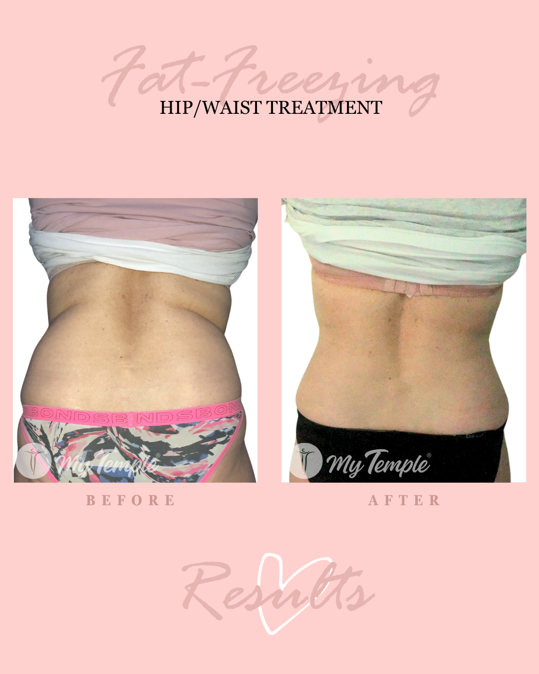 NJ hips and waist  23 4x5.png