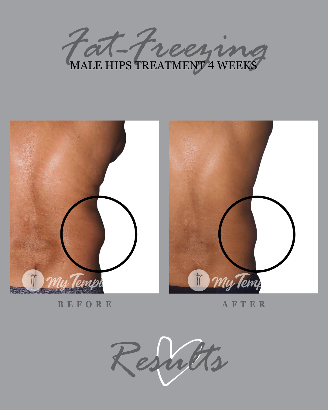 _TJ hips 30 days 4x5 .png