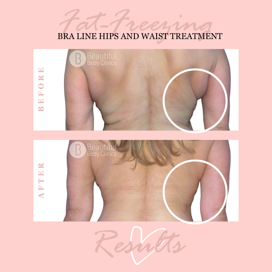 AM Bra-line and waist 23 Tira makes sure size of image is correct with new template (1).png
