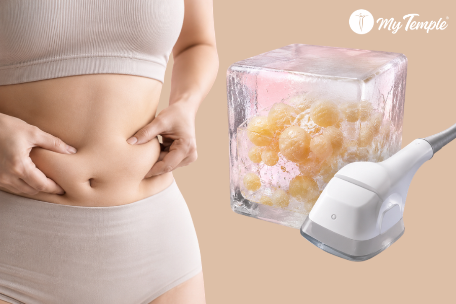 Stubborn Fat After Weight Loss: Why It Happens and What Actually Helps