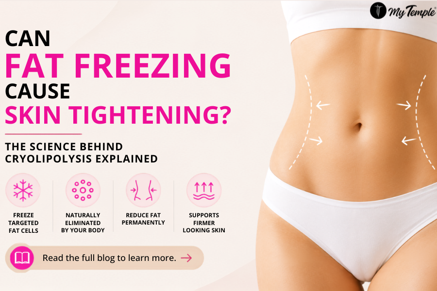 Can Fat Freezing Cause Skin Tightening? The Science Behind Cryolipolysis Explained