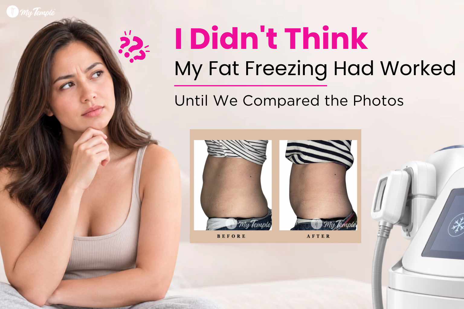 “I Didn’t Think My Fat Freezing Had Worked” - Until We Compared the Photos