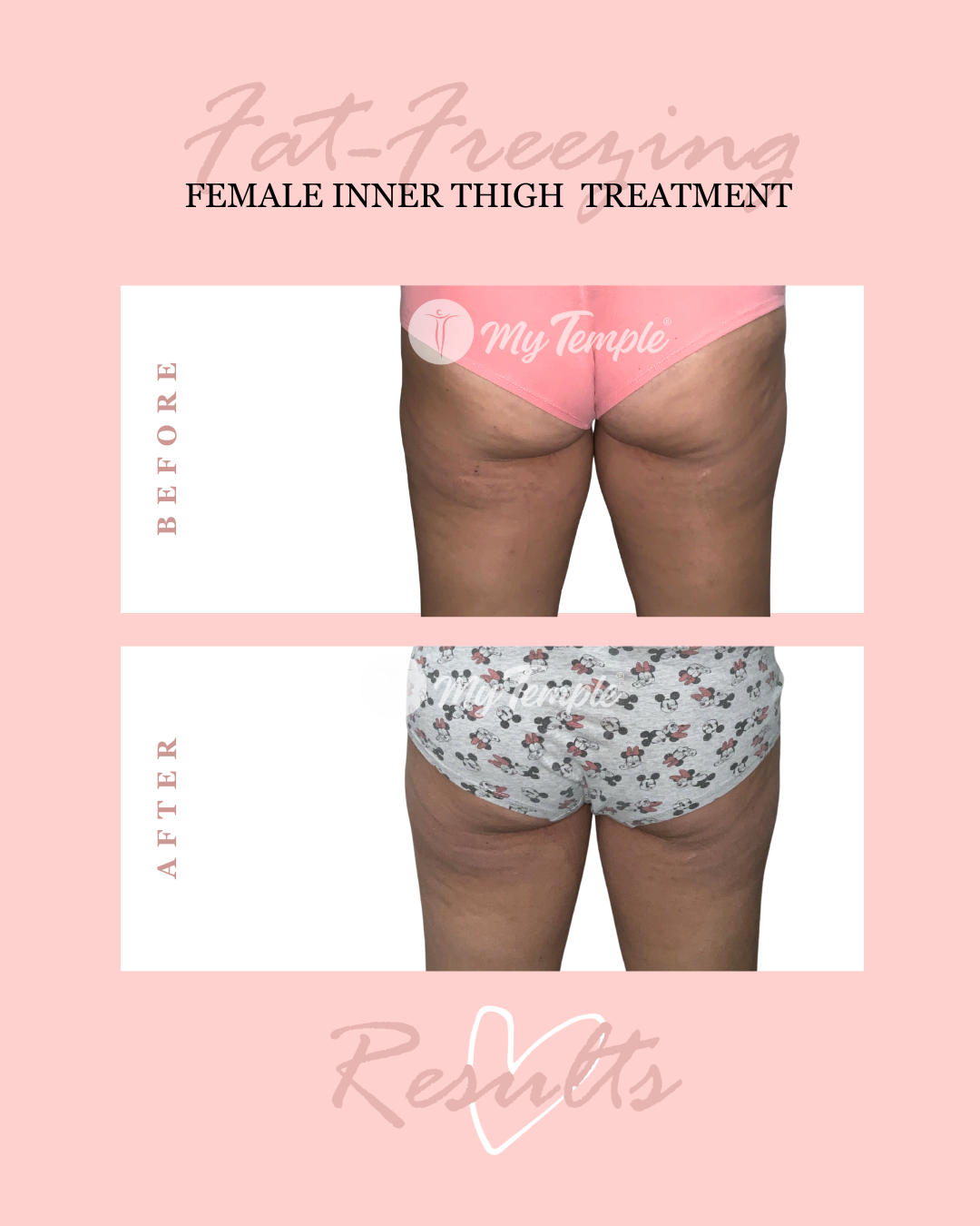 Diana W abdo hips inner thighs  (2).png