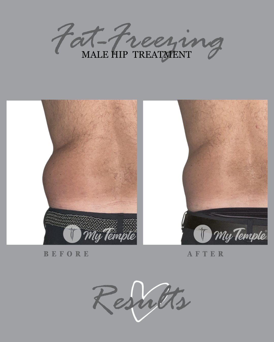 YF male hips 4x5 (2).png