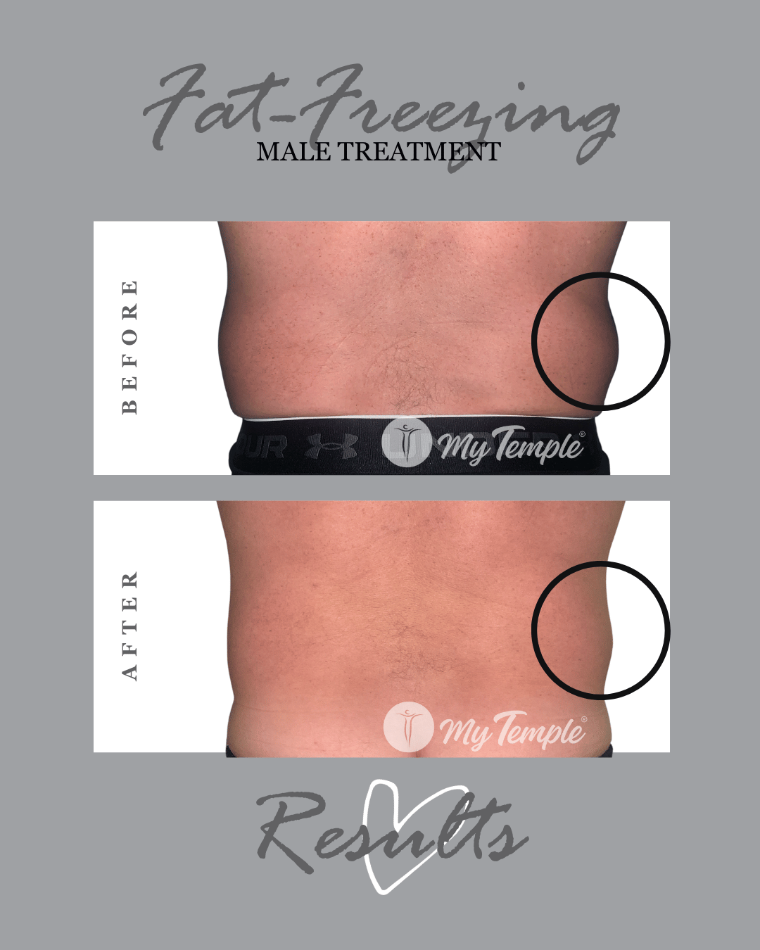 Man hips Male KR 23 4x5 (1).png