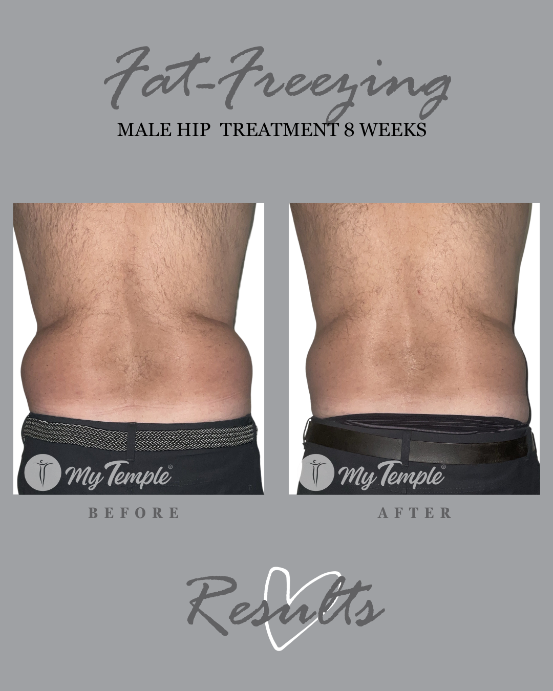 YF male hips 4x5.png