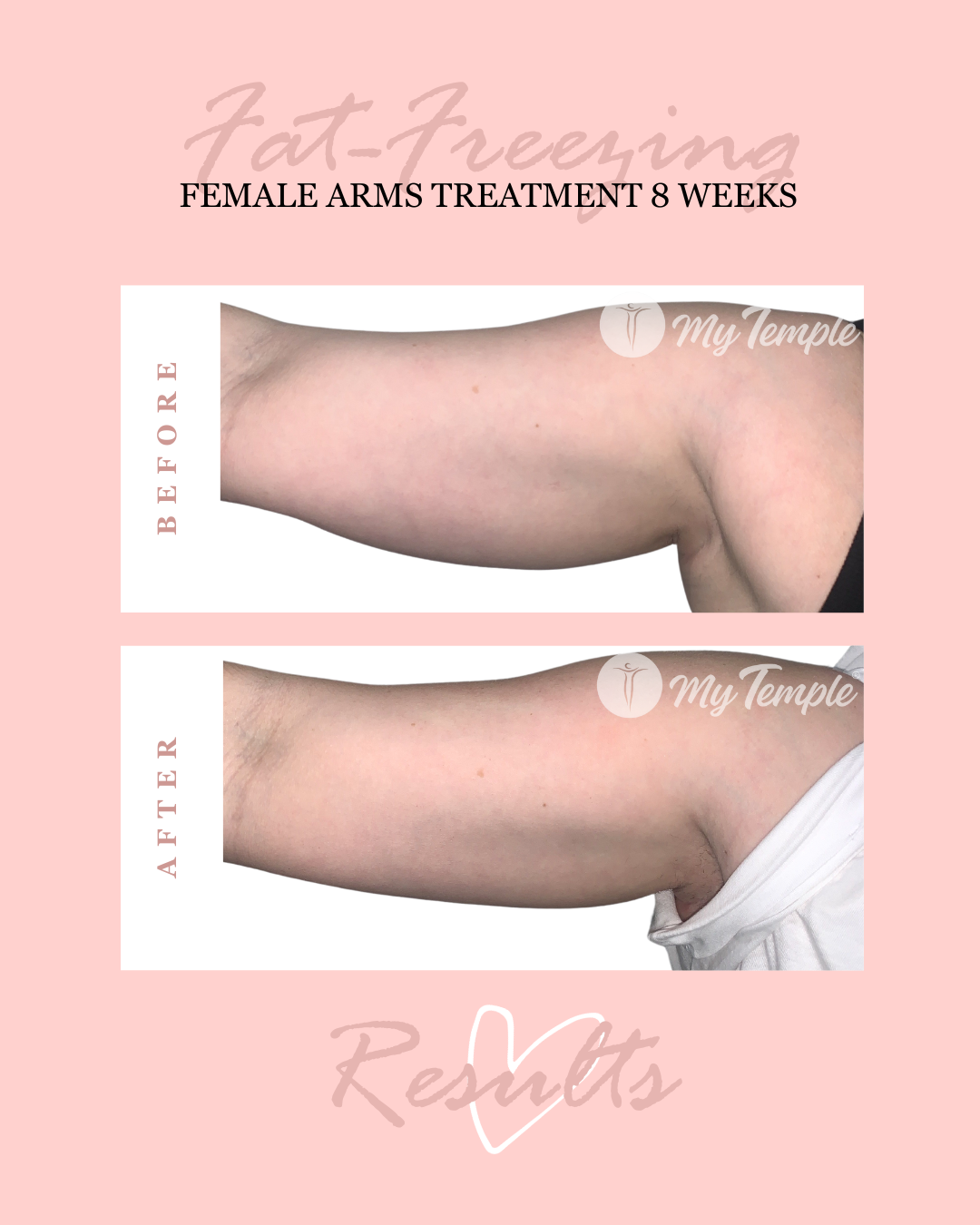 Jessica s arms 8 weeks 4x5 .png