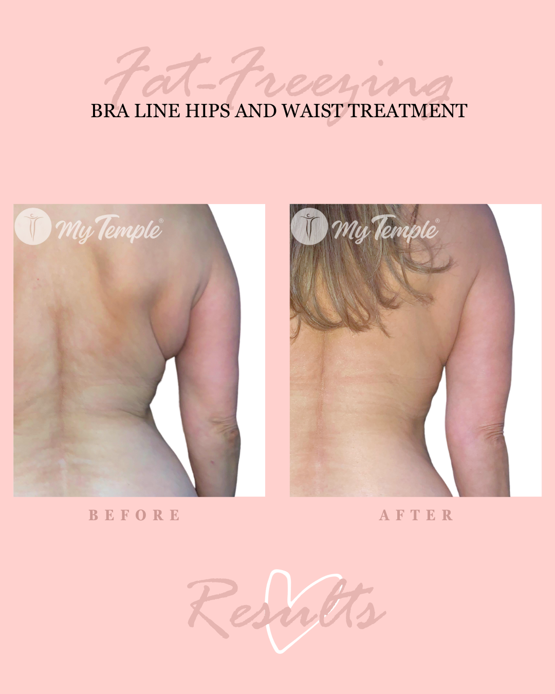 AM bra and hips 4x5.png