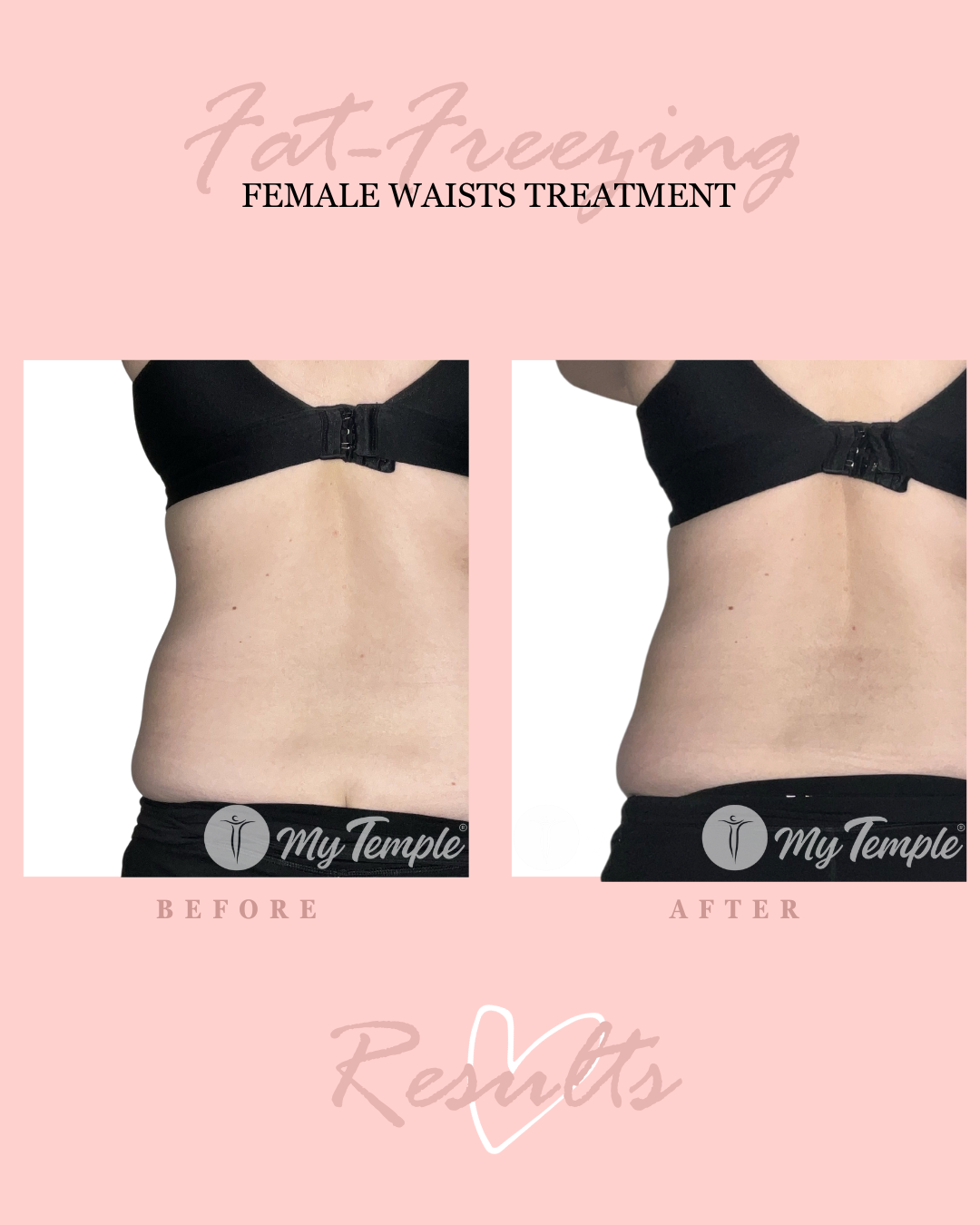 MM abdo waist 25 (1).png
