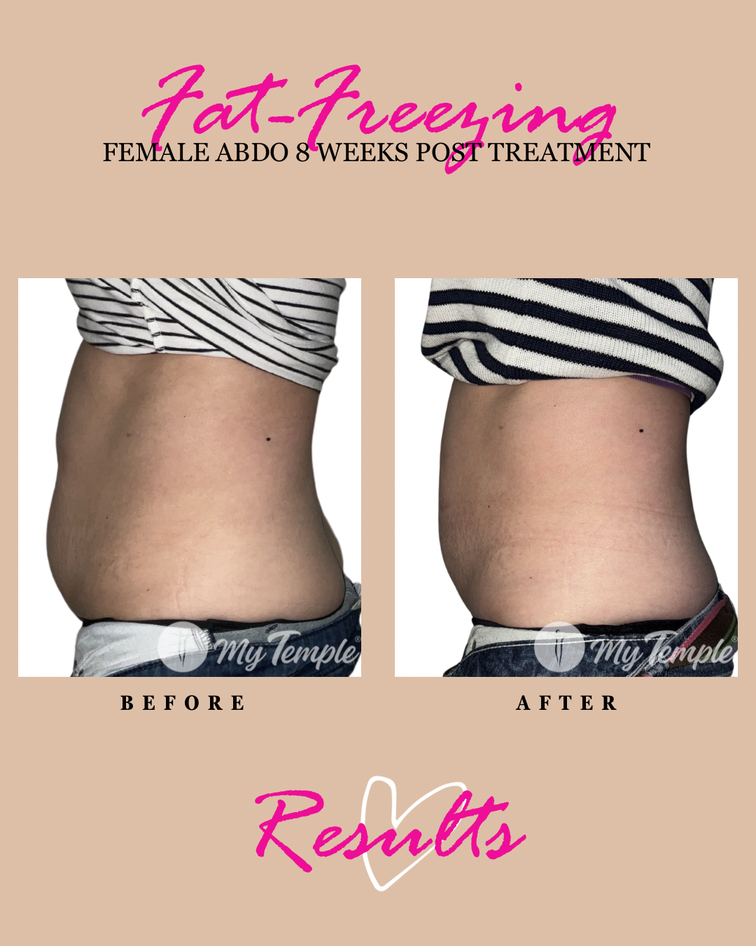 Tinh L abdo 8 weeks 4x5 - 1.png
