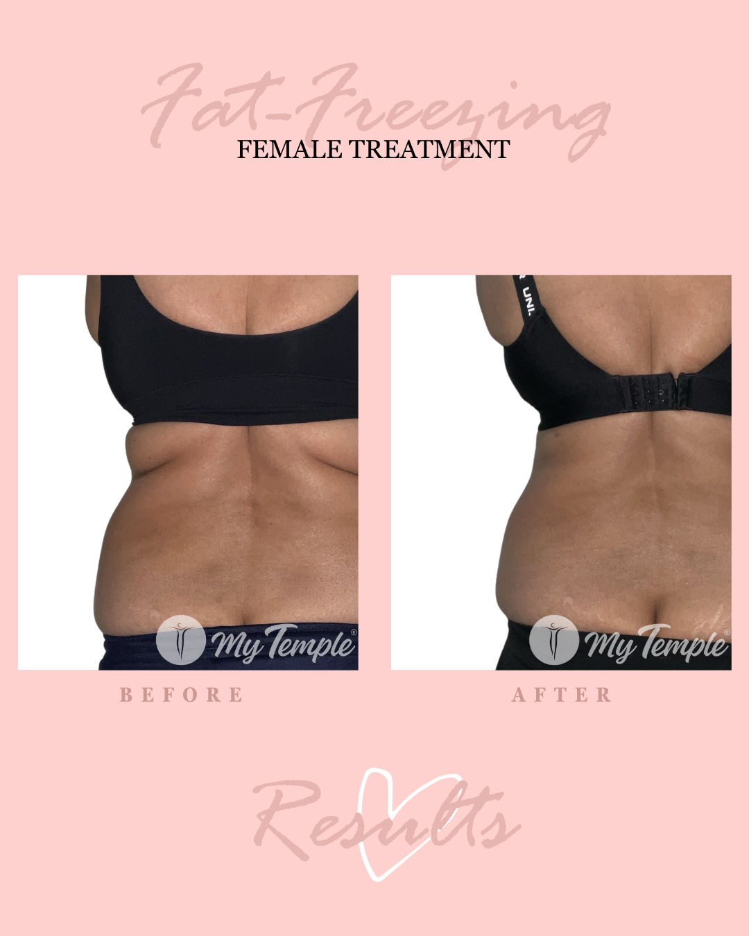 SK abdo and hips 4x5 (4).png