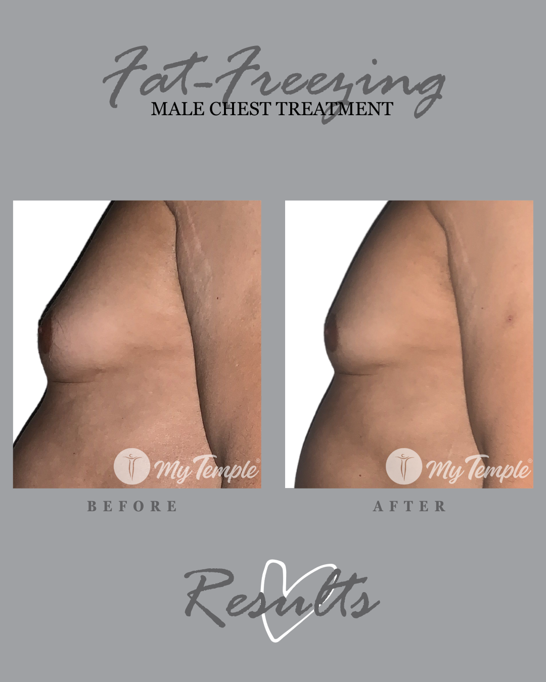 TJ chest 30 days (4x5).png