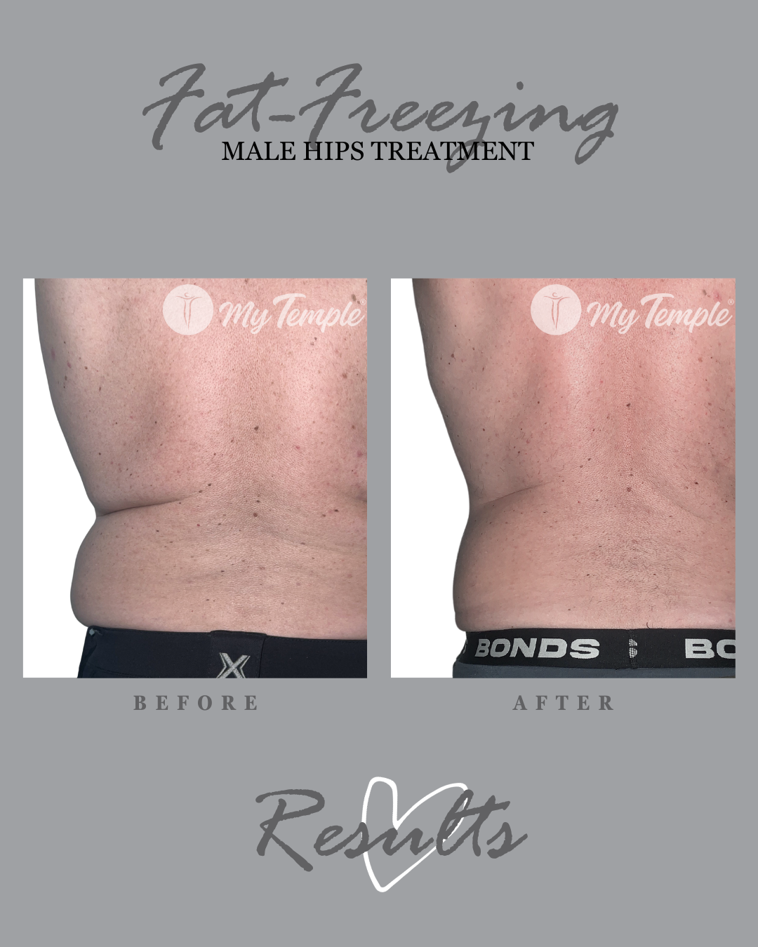 Male JM 180 hips 23 4x5 .png