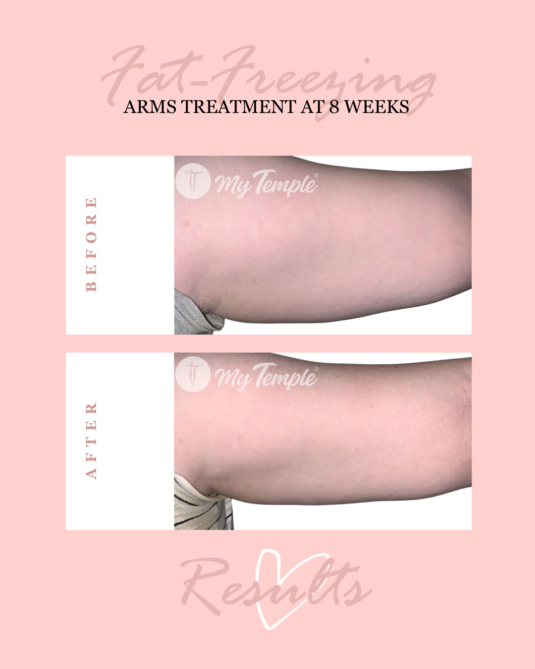 JN arms 8 weeks 4x5 .png