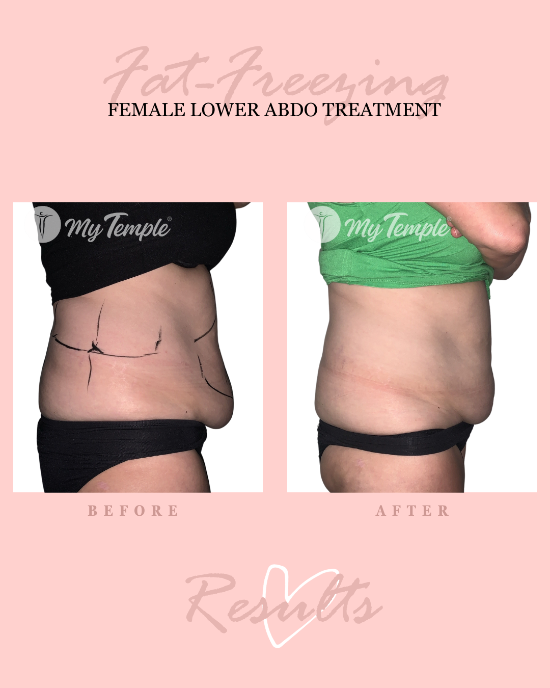 M Abdomen 4x5 (1).png