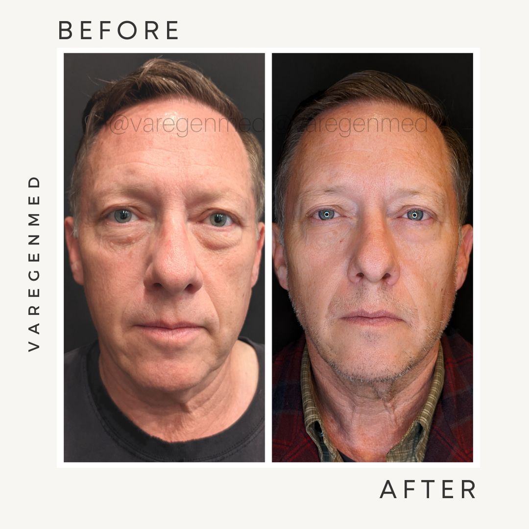 Copy of Clean Medspa + Skincare Static Posts (Square) 40.png