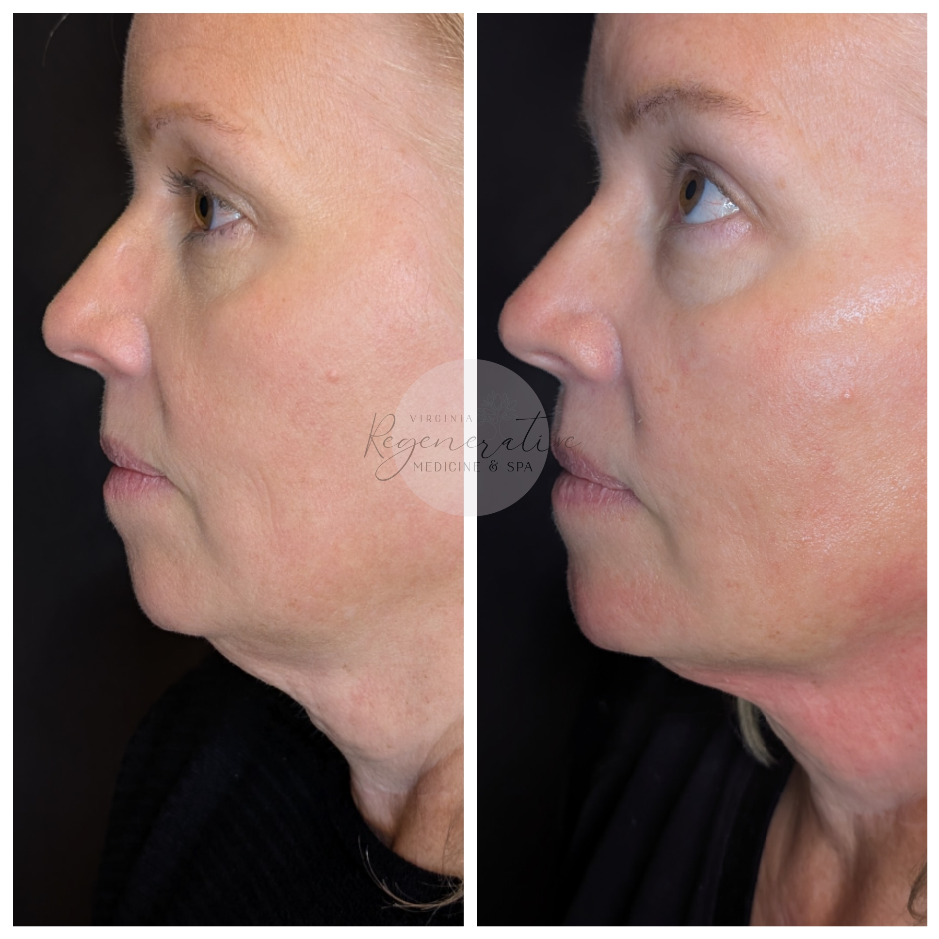 Untitled design (71).png