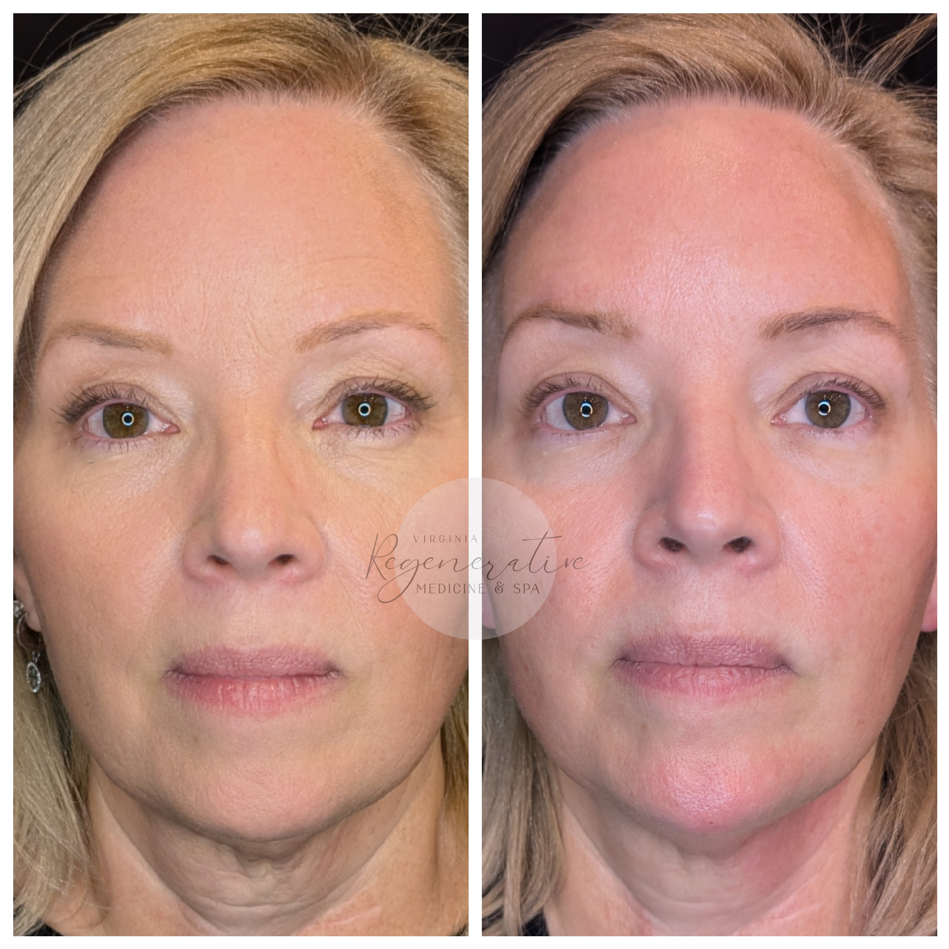 Untitled design (70).png