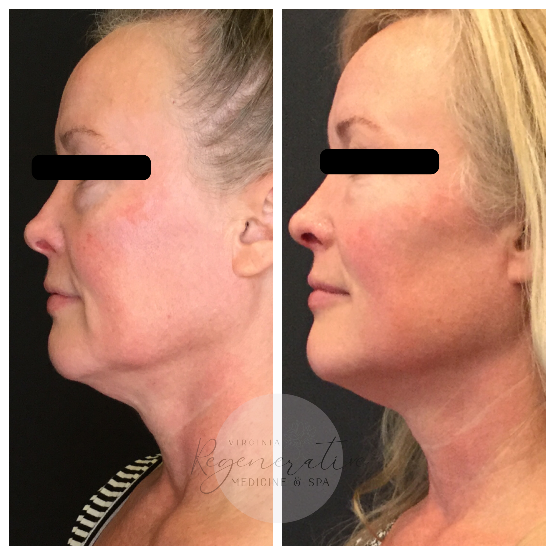 Untitled design (66).png