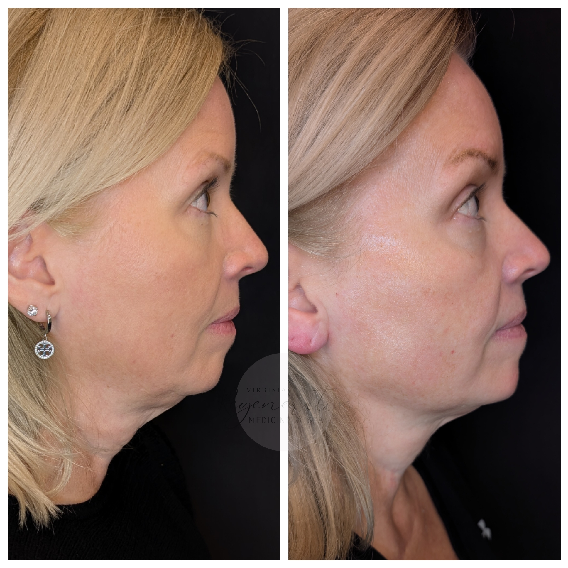 Untitled design (69).png